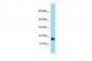 TCF21 antibody - N-terminal region